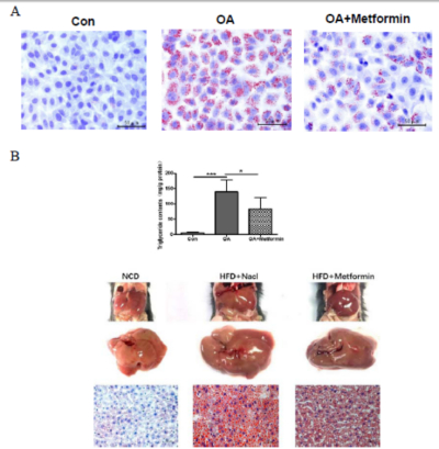 油酸酯（油酸钠）建立HepG2、LO2脂肪肝细胞模型（NAFLD）
