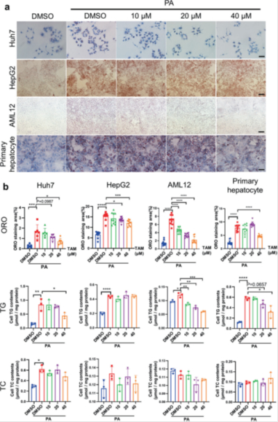 Huh 7、HepG2、AML 12、原代肝细胞高脂细胞模型建立方法（细胞脂毒性模型）