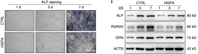 Bone Research（2025/IF=14.3）：高糖高脂模拟糖尿病微环境处理MC3T3-E1成骨细胞建立细胞高脂损伤模型