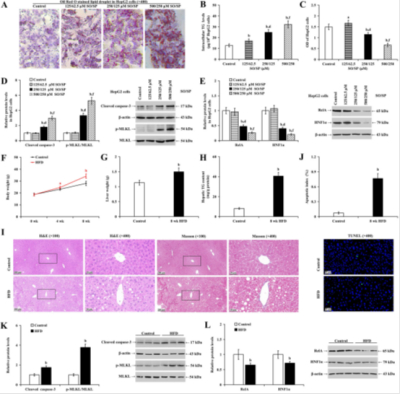 Cell Death Discovery（IF/6.1）：高脂细胞添加剂诱导肝细胞建立脂肪变性模型（脂质沉积与细胞损伤）