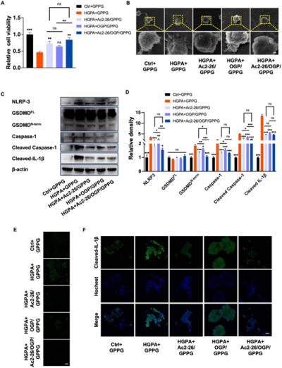 Biofabrication（IF/8.2）：高糖/棕榈酸（HGPA）模拟体外糖尿病炎症环境并诱导巨噬细胞焦亡